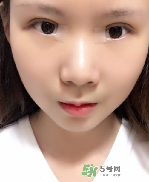 美皮護(hù)去疤效果怎么樣？美皮護(hù)有用嗎？