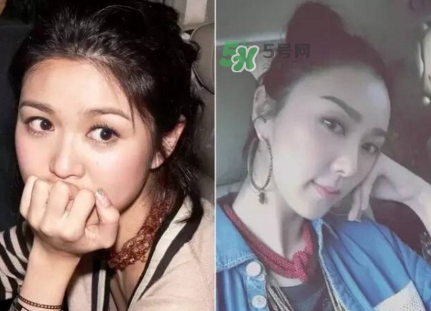 發(fā)際線低怎么調(diào)整？標準的發(fā)際線圖片