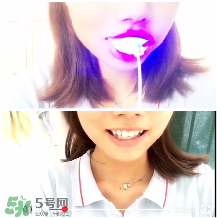 美牙儀能治氟斑牙嗎？氟斑牙可以用美白儀嗎？