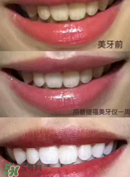 美牙儀能用水洗嗎？美牙儀能用多久？
