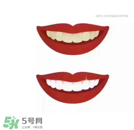美牙儀能帶上飛機(jī)嗎？美牙儀可以過(guò)安檢嗎？