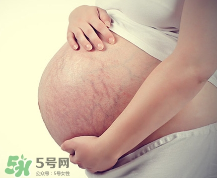 孕婦胸部長妊娠紋嗎？胸部長妊娠紋了怎么辦？