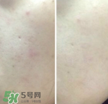 美康粉黛氣墊bb怎么樣？美康粉黛氣墊bb毀容