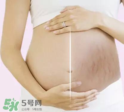 長妊娠紋的前兆 長妊娠紋很癢怎么辦？