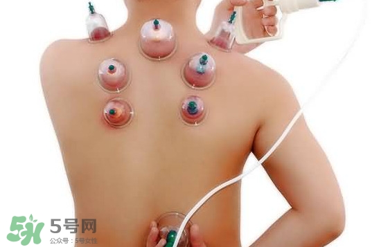 火罐和真空罐哪個(gè)好？真空罐和火罐效果一樣好嗎