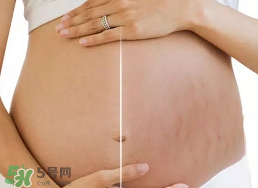 脖子上會長妊娠紋嗎？妊娠紋長在哪些地方？
