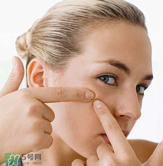 長痘長閉口怎么辦？長痘長閉口是什么原因？