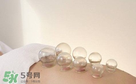 真空拔罐有用嗎？真空拔罐多長時(shí)間合適