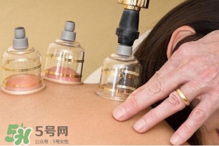 真空拔罐有用嗎？真空拔罐多長時(shí)間合適