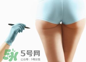 吸脂減肥副作用有哪些？吸脂減肥可靠嗎？