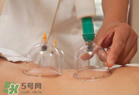 真空拔罐有用嗎？真空拔罐多長時(shí)間合適