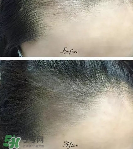 發(fā)際線粉要卸妝嗎_怎么卸？