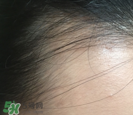 發(fā)際線粉要卸妝嗎_怎么卸？