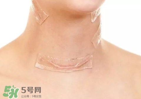 硅膠疤痕貼有用嗎？硅膠疤痕貼效果怎么樣？