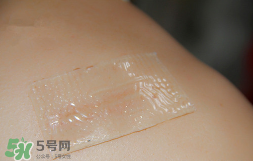 仙卡疤痕貼有用嗎？仙卡疤痕貼效果怎么樣？