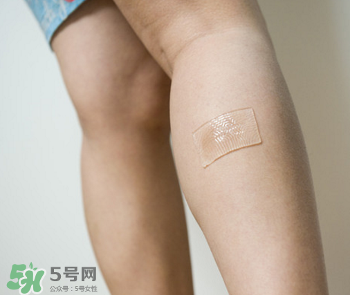 仙卡疤痕貼哪里有賣？正品仙卡疤痕貼在哪里買？