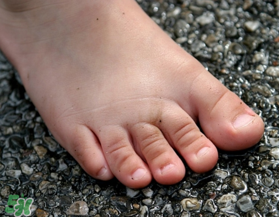 日本灰指甲藥水有用嗎？日本灰指甲藥水評測