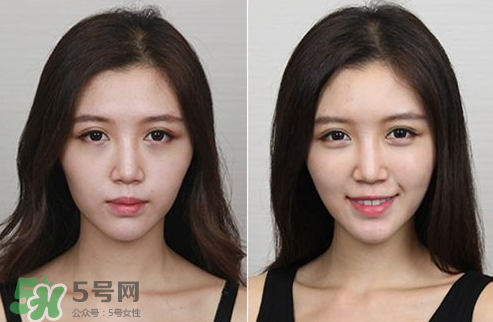 蘋(píng)果肌怎么化？蘋(píng)果肌究竟哪里好？