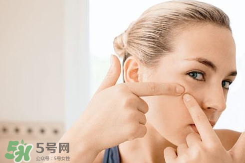 暗瘡可以擠壓嗎？油性和骯臟肌膚會容易有暗瘡嗎？