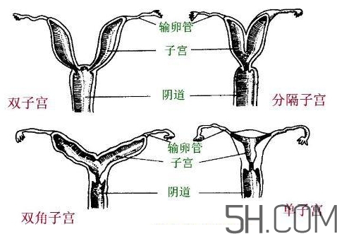 子宮畸形有哪些？子宮畸形有什么影響？