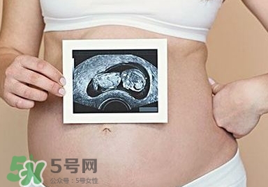 雙子宮可以上環(huán)嗎？雙子宮上環(huán)要注意哪些？