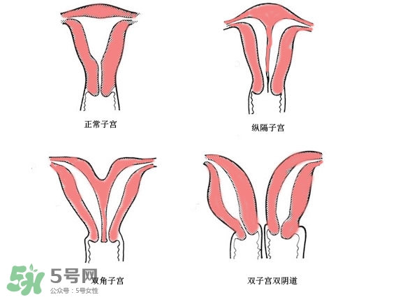 雙子宮是什么意思？雙子宮可以順產(chǎn)嗎？