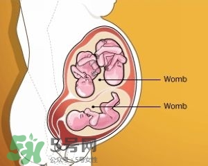 雙子宮是什么意思？雙子宮可以順產(chǎn)嗎？