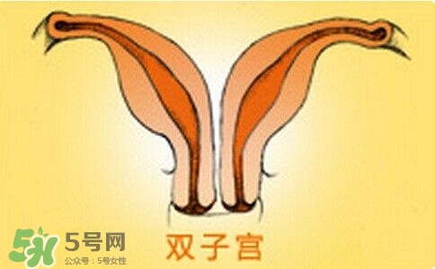 雙子宮是什么意思？雙子宮可以順產(chǎn)嗎？