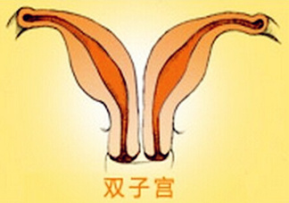 雙子宮是什么意思？雙子宮可以順產(chǎn)嗎？