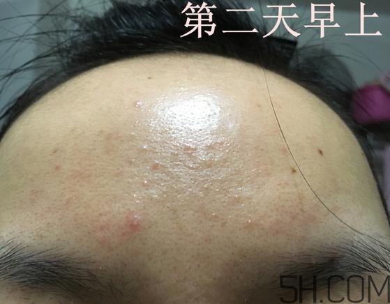 nyr金盞花膏怎么樣_nyr金盞花膏好用嗎 nyr金盞花膏怎么樣_nyr金盞花膏好用嗎