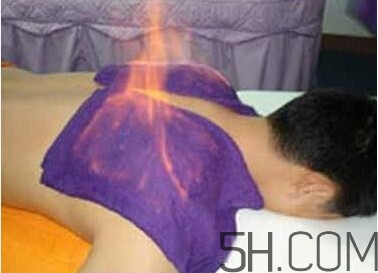 火療真的能治病嗎？火龍液的功效與作用