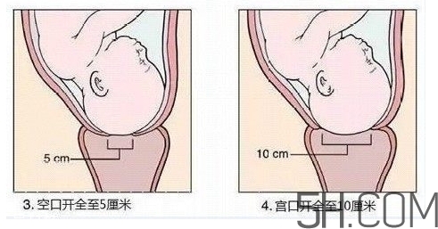 內(nèi)檢是什么感覺？內(nèi)檢有男醫(yī)生嗎？