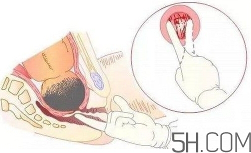內(nèi)檢是什么感覺？內(nèi)檢有男醫(yī)生嗎？
