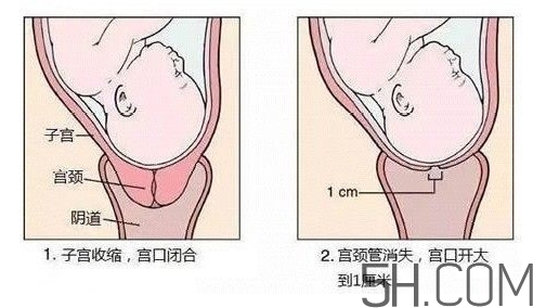 內(nèi)檢是什么感覺？內(nèi)檢有男醫(yī)生嗎？