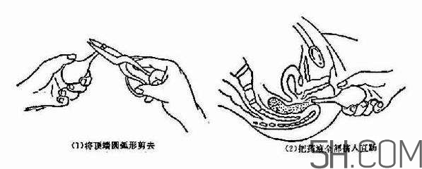 開塞露怎么用？開塞露用后多久會(huì)排便？