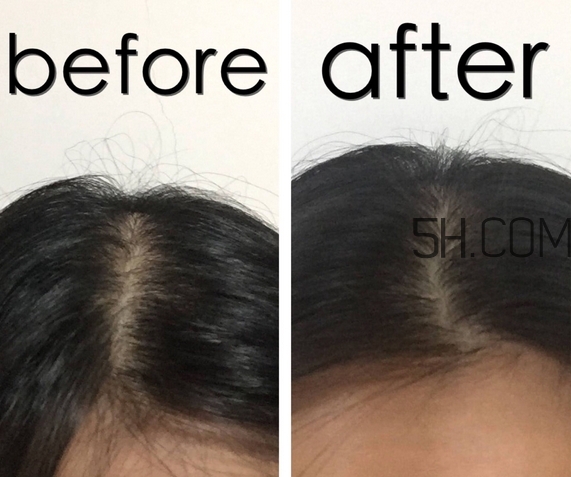 滋源洗發(fā)水多少錢一瓶_滋源洗發(fā)水價(jià)格表 滋源洗發(fā)水多少錢一瓶_滋源洗發(fā)水價(jià)格表