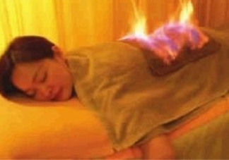 火療能治婦科病嗎？火療能去濕氣嗎