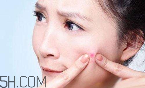 泊美祛痘系列怎么樣？泊美祛痘系列有哪些？