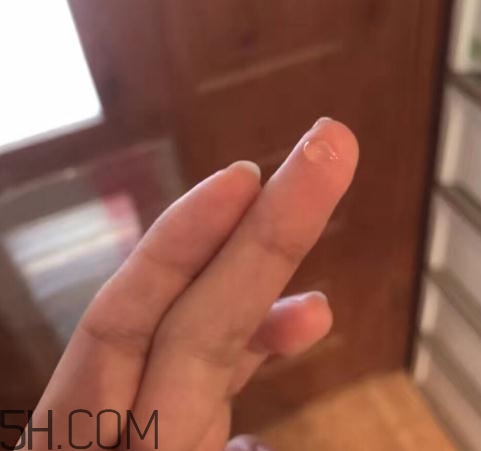倍舒痕可以去痘印嗎？倍舒痕能涂在痘痘上嗎？