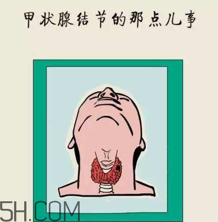 為什么會得甲狀腺結節(jié)？甲狀腺節(jié)結是什么？