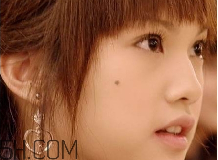 痣是怎么形成的？女人痣長哪里最有福氣