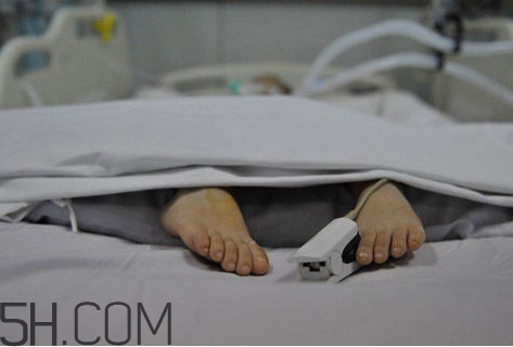 腦死亡是什么意思？腦死亡判定有嚴(yán)格標(biāo)準(zhǔn)