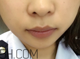 小蜜蜂細致修護唇膏很油嗎？夏天用合適嗎？