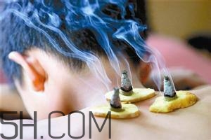 艾灸對(duì)慢性咽炎有用嗎？慢性咽炎可以通過艾灸來治療嗎？