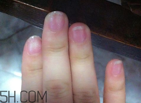 美甲后指甲受損怎么辦？指甲破損怎么修復(fù)？