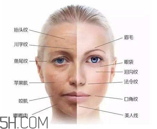 怎么預防皺紋的產生？導致皺紋的產生的原因有哪些？