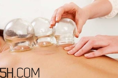 拔罐可以治療鼻炎嗎？鼻炎拔罐拔哪里？