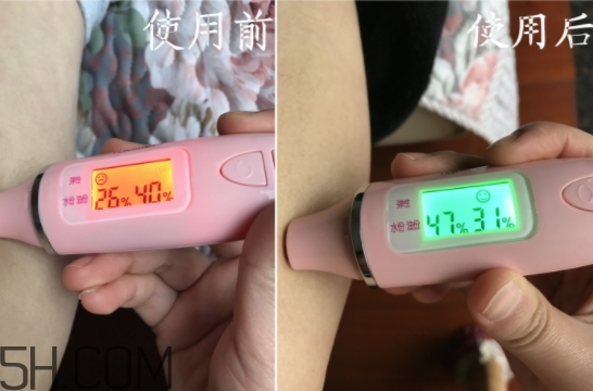 水楊酸可以去黑頭嗎？水楊酸可以去閉口嗎