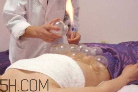 腹部拔罐可以減肥嗎？腹部拔罐拔哪個(gè)位置？