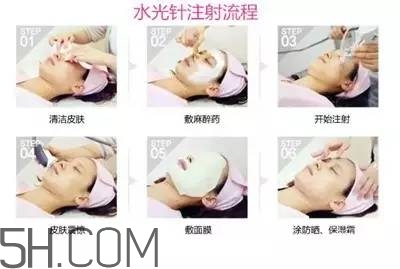 打水光針多久打一次？水光針的誤區(qū)